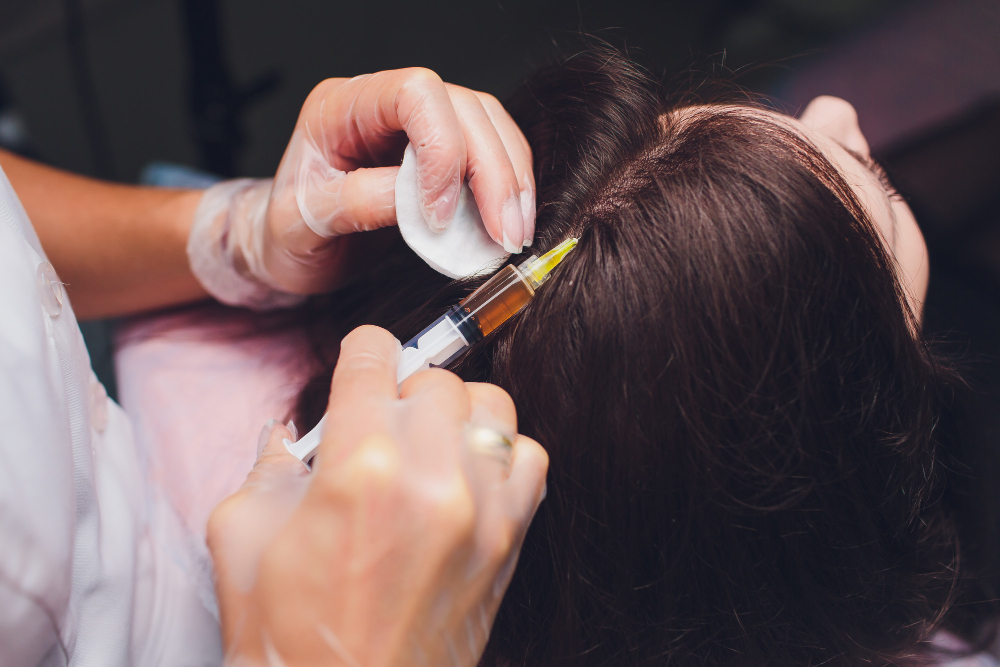 PRP Injections